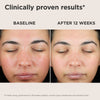 EltaMD UV Skin Recovery Red Color Correcting Green Tint Broad Spectrum SPF 50