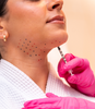 Kybella® Precision Fat Dissolving