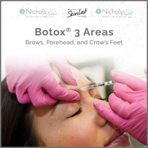 NMD SHOP Botox 3 Areas