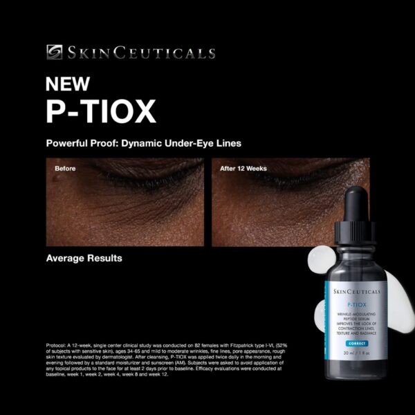 NMD SHOP P TIOX B&A Dynamic Under Eye Lines